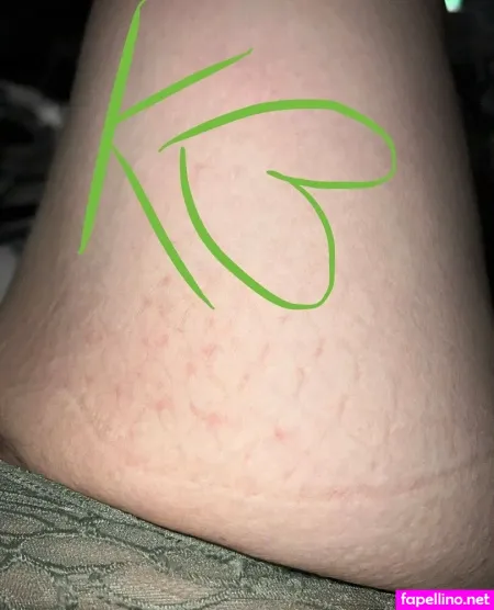 Killerb0o OnlyFans Thumbnail #QEFAppcRTj