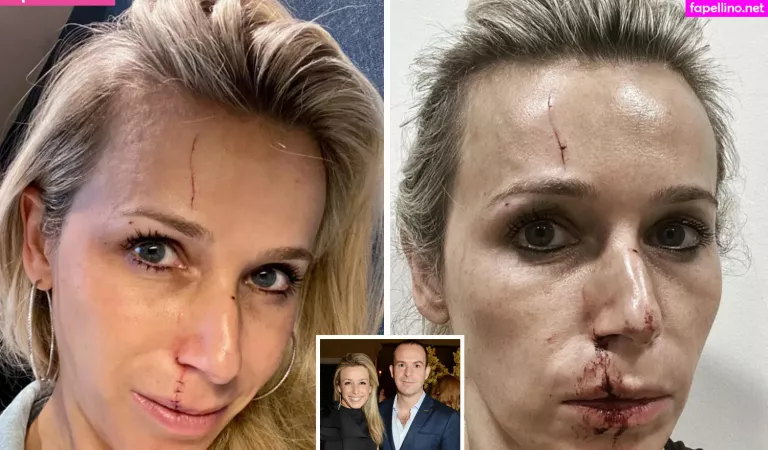 Lara Lewington OnlyFans Thumbnail #IJQRacSvUx