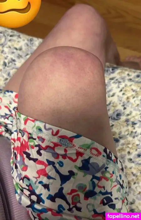 Leglessdesires OnlyFans Thumbnail #engAcftJgZ