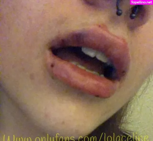 Lolaceline OnlyFans Thumbnail #cFVpvSxiZg