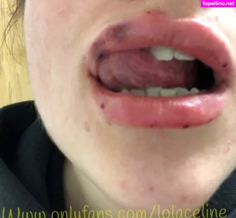 Lolaceline OnlyFans Thumbnail #lKKQD7gFfx