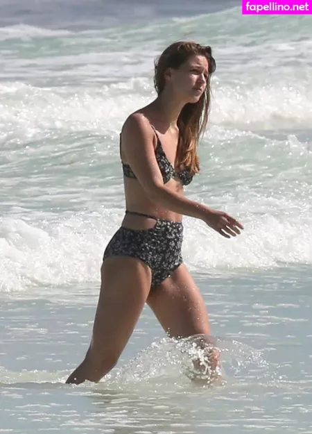 Melissa Benoist OnlyFans Thumbnail #ZV2RurhnuR