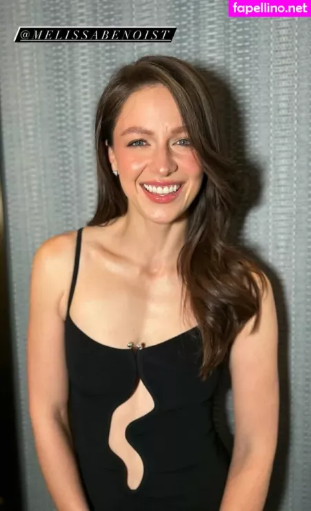 Melissa Benoist OnlyFans Thumbnail #kDXes9qFbO