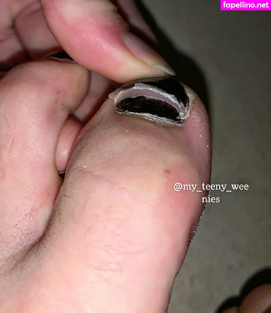 my_teeny_weenies Nude Leaked OnlyFans Photo #uTFHaxuS5T