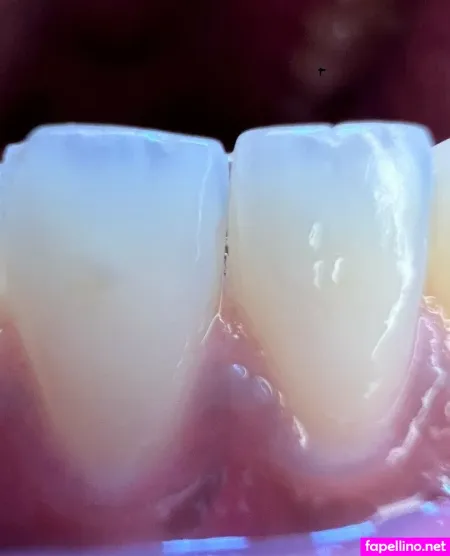 N3edymouth OnlyFans Thumbnail #DZMm72GjtP