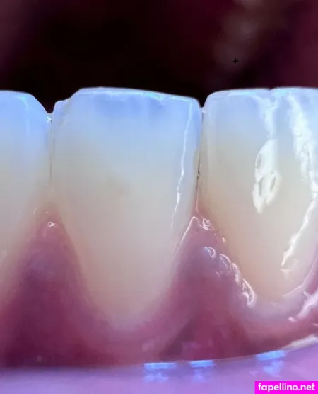 N3edymouth OnlyFans Thumbnail #VFeJnABH0p