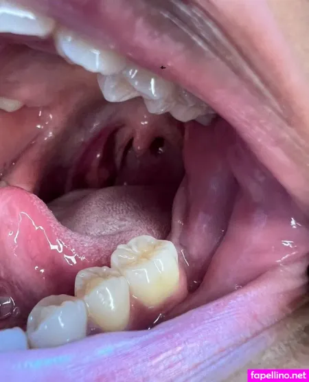 N3edymouth OnlyFans Thumbnail #etLFyIoC2d