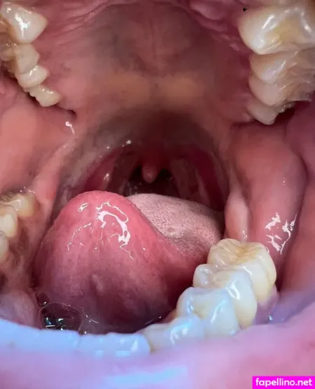 N3edymouth OnlyFans Thumbnail #mSwt6ZtbXj