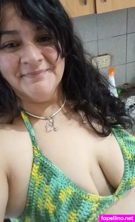 Nurse69cindy OnlyFans Thumbnail #TEp9aOj41E