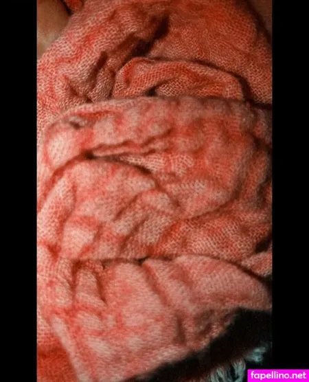 Obs Cure OnlyFans Thumbnail #BB6bBeDKCz