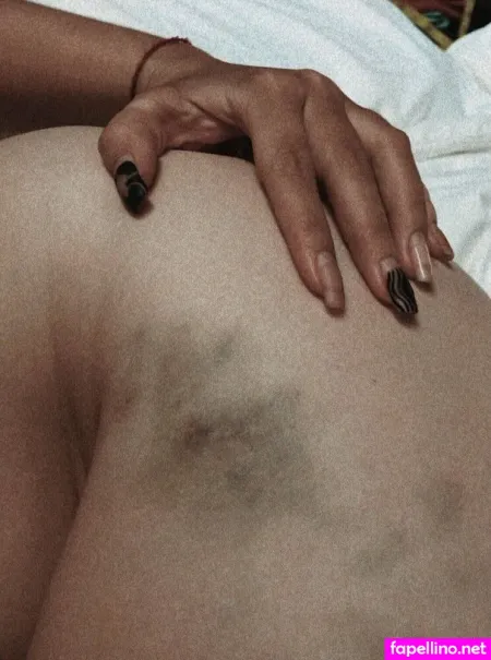 Obs Cure OnlyFans Thumbnail #C5z0w978Q2