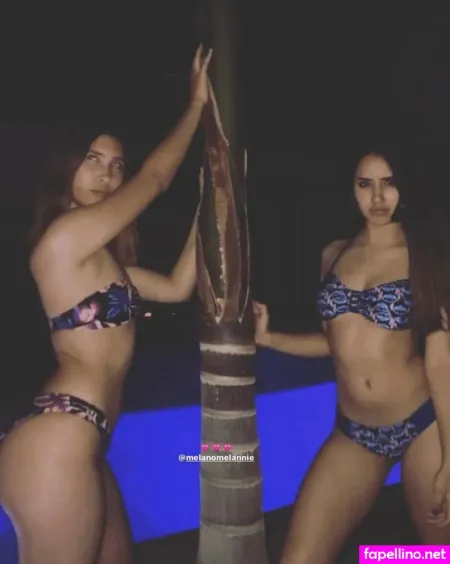 Odette Orlena OnlyFans Thumbnail #gplH7ds31P