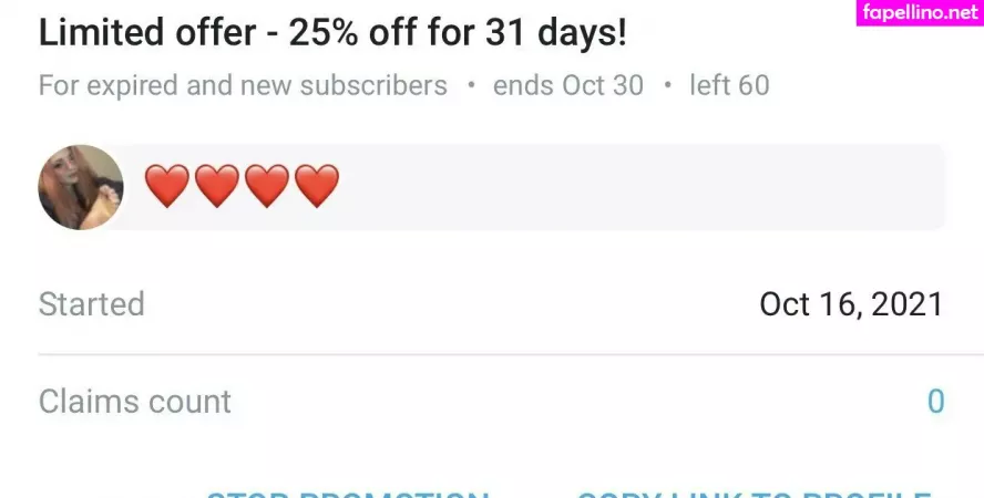 Oliviafeetqueen OnlyFans Thumbnail #R1YBGgQ43v