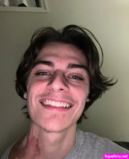 Onearmseeker OnlyFans Thumbnail #Bn9g1ky0zp