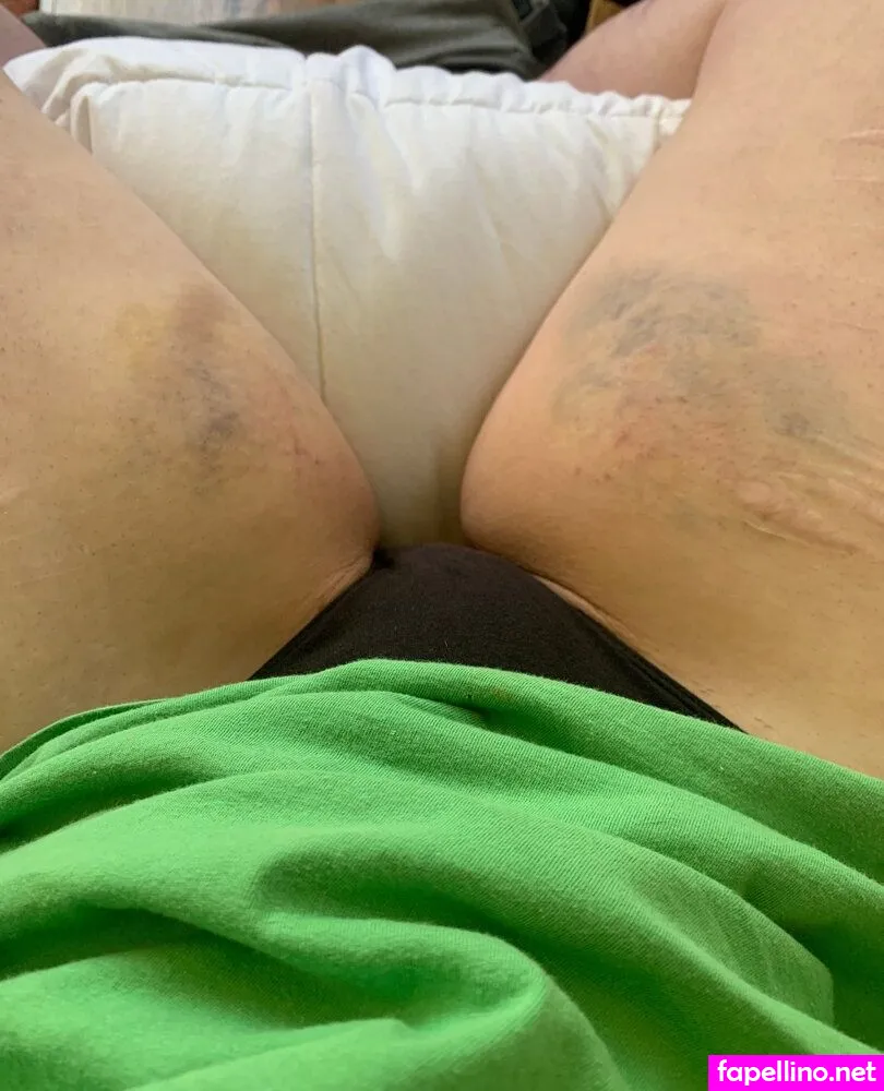 dentata69, punishmentslut Nude Leaked OnlyFans Photo #LC9k4sOJ5V