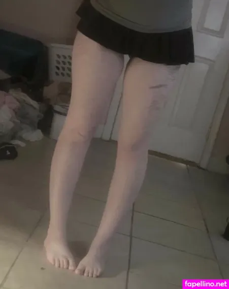 Sickndcute OnlyFans Thumbnail #78etItp8yy