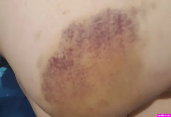 Snoopysoap OnlyFans Thumbnail #j8SlFoPt3n