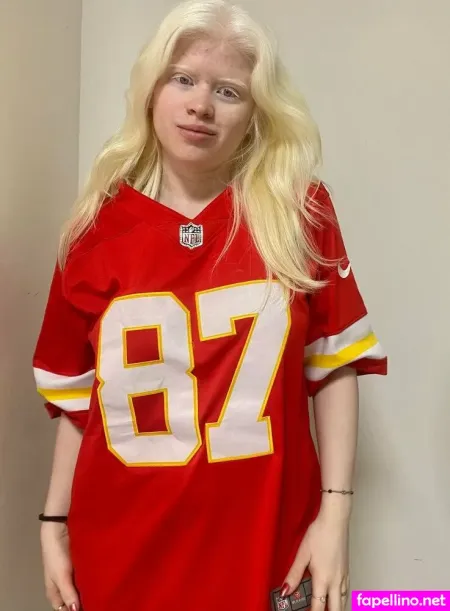 Snowwhitebellaxo OnlyFans Thumbnail #QNhhNi2rHv