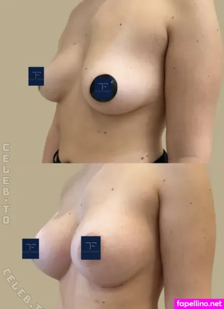 Stefanie Emig OnlyFans Thumbnail #R7Tdmd0wD1