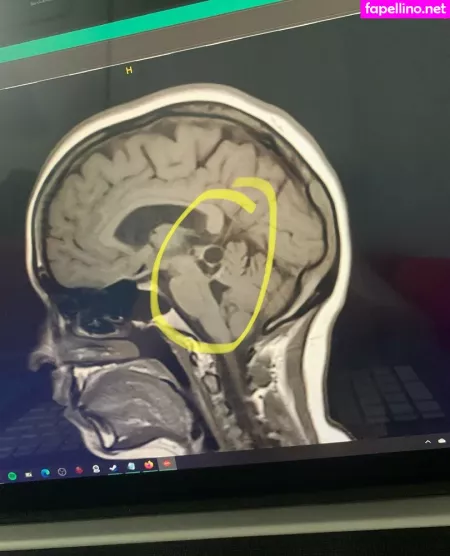 Sultriefetche4u OnlyFans Thumbnail #uMyS0IiCZT