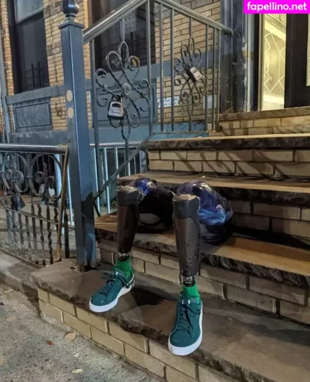 Theamputeebitch OnlyFans Thumbnail #O4WO7wZYMi