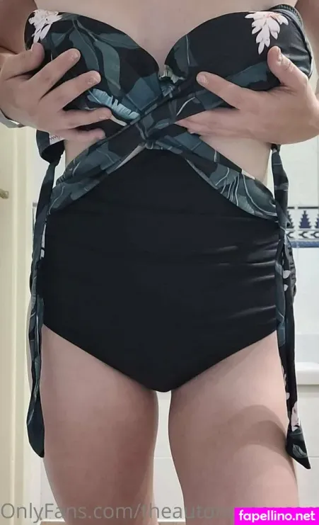 Theautonomousamputee2 OnlyFans Thumbnail #O8AcTrSs1B