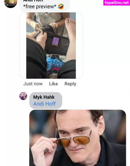 Theradicalfox OnlyFans Thumbnail #NMArQrspoJ