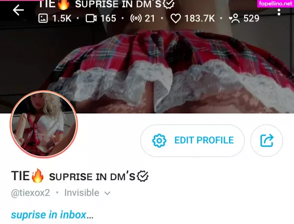 Tieexox3 OnlyFans Thumbnail #1VLTD4yE1L