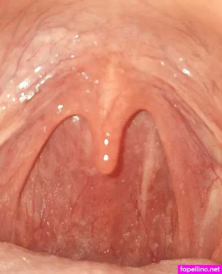 Tiny Uvula Main Profile Photo