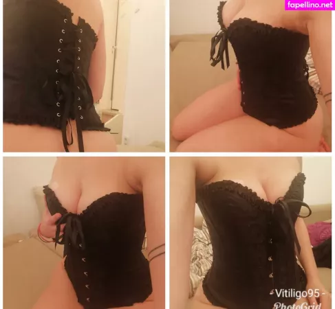 Vitiligo95 OnlyFans Thumbnail #5JLuUKMNFR