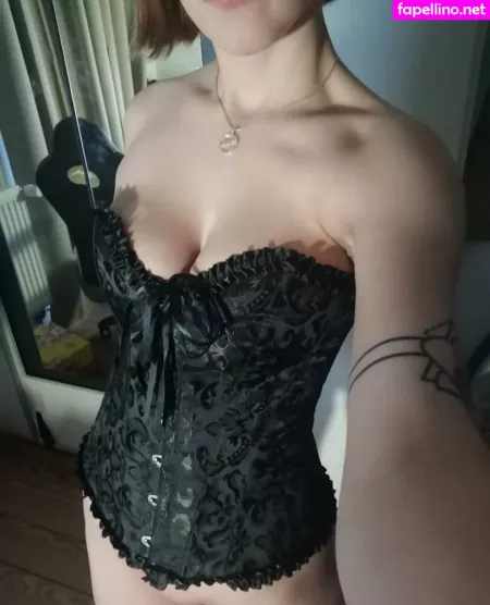 Vitiligo95 OnlyFans Thumbnail #KKgk5PvmrM