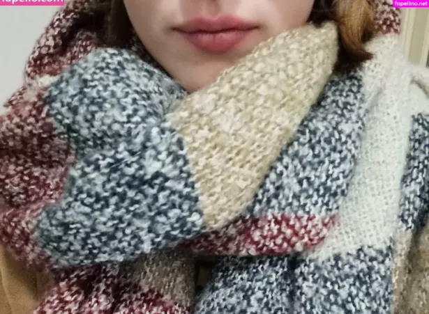 Vitiligo95 OnlyFans Thumbnail #omUCa4eNLE