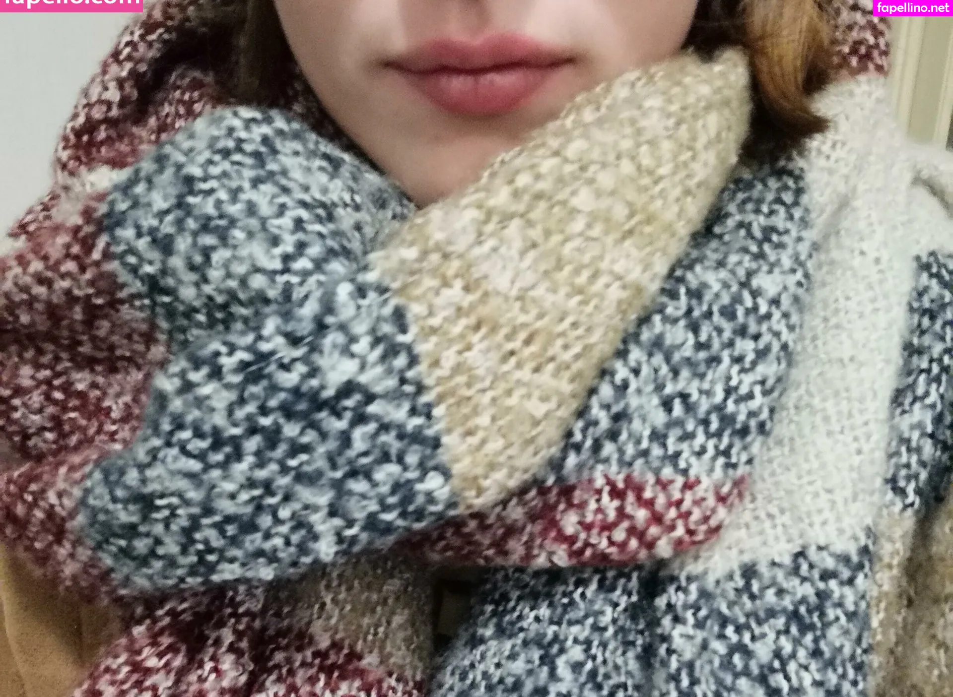 vitiligo95 Nude Leaked OnlyFans Photo #omUCa4eNLE