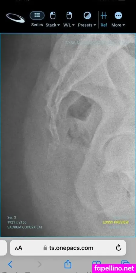 Willowisp23 OnlyFans Thumbnail #qtGCO3aBNw