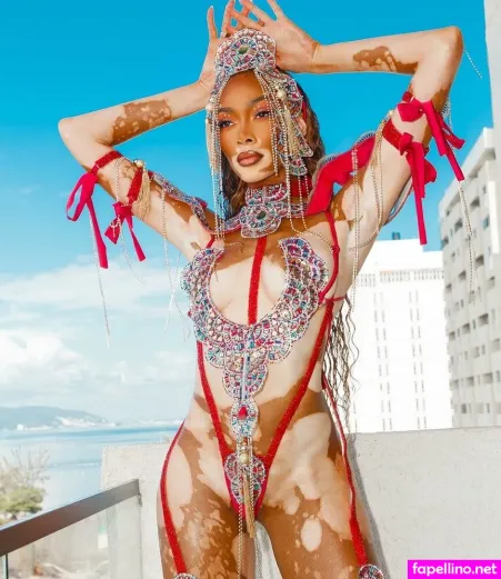 Winnie Harlow Main Profile Photo