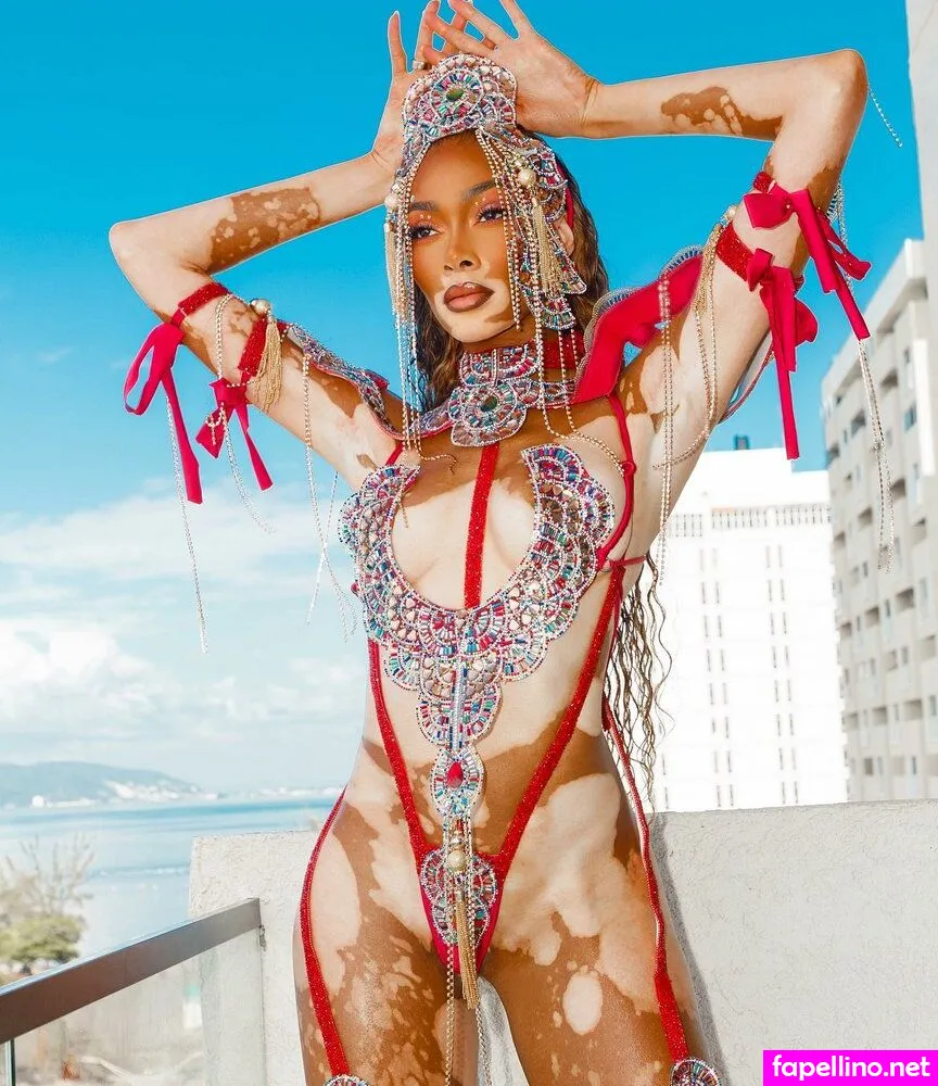 winnieharlow Nude Leaked OnlyFans Photo #8tFUPUTCQb