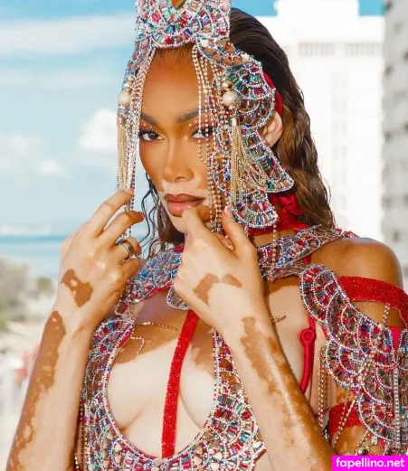 Winnie Harlow OnlyFans Thumbnail #JzIiK7KG6J
