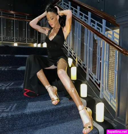 Winnie Harlow OnlyFans Thumbnail #K1lybM8fRt