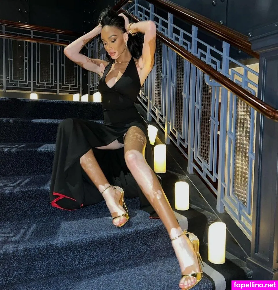 winnieharlow Nude Leaked OnlyFans Photo #K1lybM8fRt