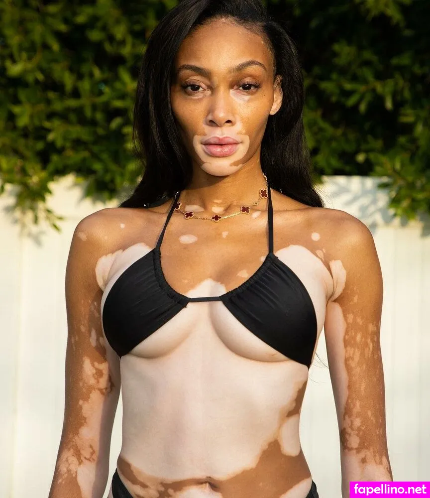 winnieharlow Nude Leaked OnlyFans Photo #d5RYMDKgBZ
