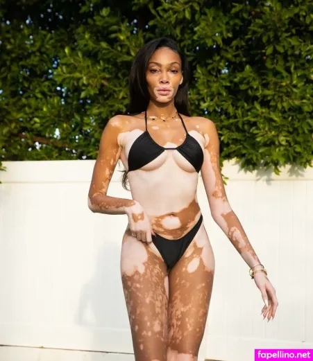 Winnie Harlow OnlyFans Thumbnail #s8y4lRfNZx