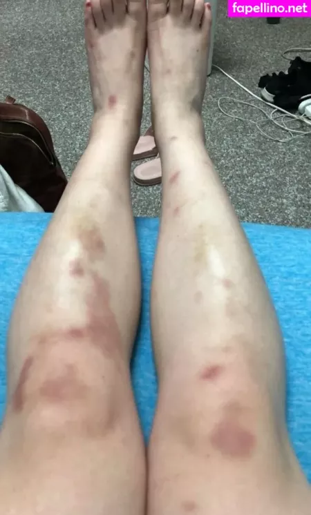 Xiaolingc OnlyFans Thumbnail #SsTFHjkkeD